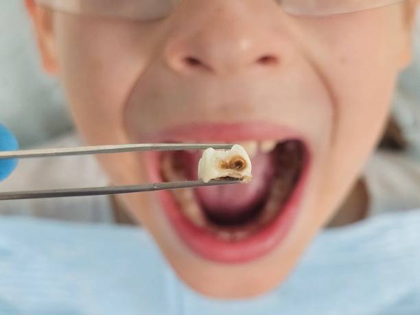 Best Tooth Pain Emergency Relief  in Winnsboro, SC